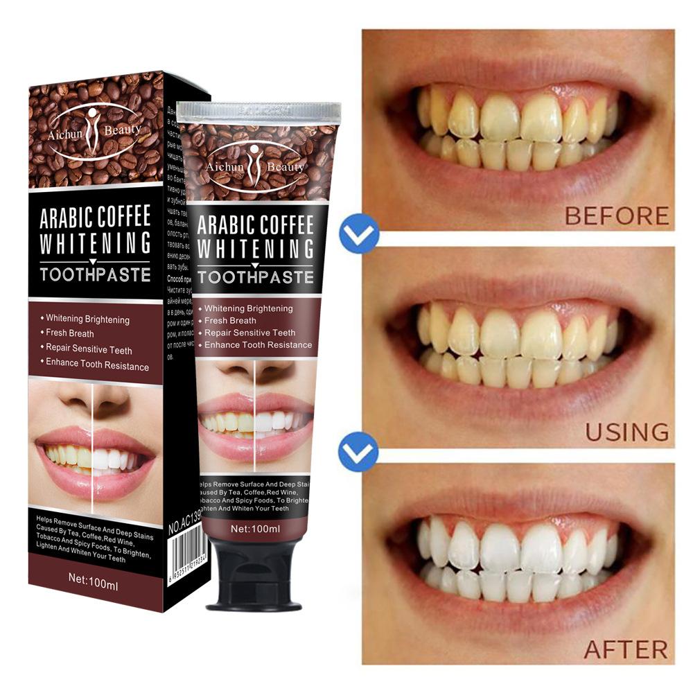 Tooth Stain Removal