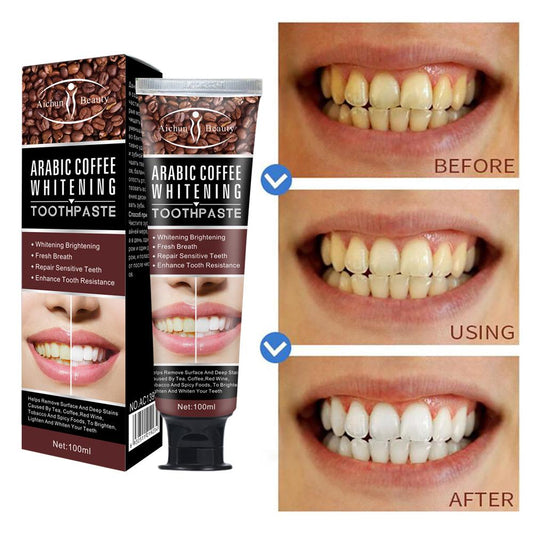 Tooth Stain Removal